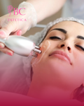 Radiofrecuencia Facial